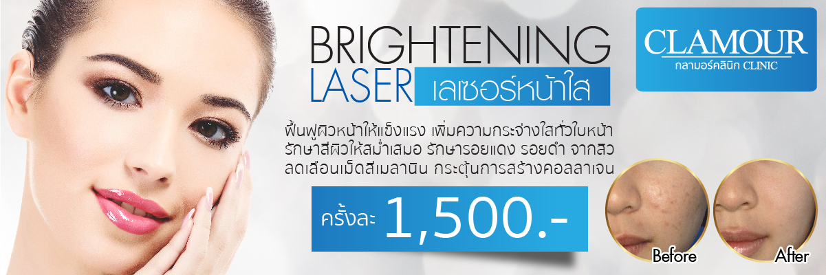 Brightening laser